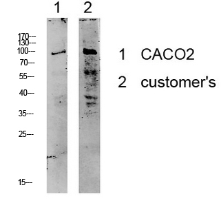 Fig.1. Western blot analysis of various lysate, antibody was diluted at 1:1000. HRP, Goat Anti-Rabbit IgG (Cat #: A21020) secondary antibody was diluted at 1:20000.