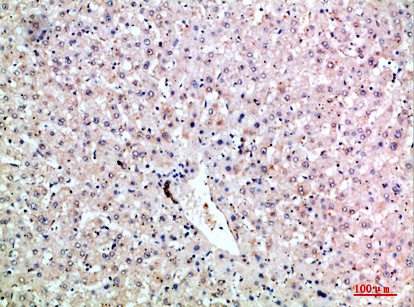 Fig.1. Immunohistochemical analysis of paraffin-embedded human-liver, antibody was diluted at 1:200.