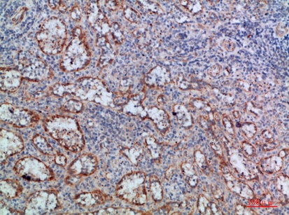 Fig.3. Immunohistochemical analysis of paraffin-embedded human-spleen, antibody was diluted at 1:200.