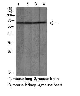 Fig.1. Western blot analysis of human blood lysate, antibody was diluted at 1:1000. HRP, Goat Anti-Rabbit IgG (Cat #: A21020) secondary antibody was diluted at 1:20000.