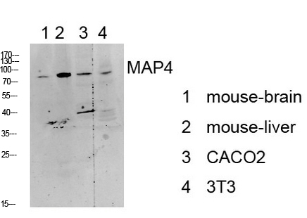 Fig.1. Western blot analysis of various lysate, antibody was diluted at 1:1000. HRP, Goat Anti-Rabbit IgG (Cat #: A21020) secondary antibody was diluted at 1:20000.