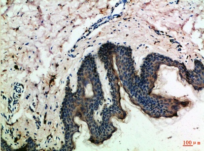 Fig.1. Immunohistochemical analysis of paraffin-embedded Human-skin, antibody was diluted at 1:100.