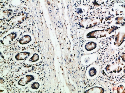 Fig.2. Immunohistochemical analysis of paraffin-embedded Human-colon, antibody was diluted at 1:100.