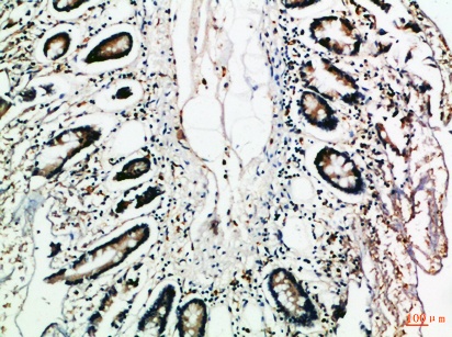 Fig.3. Immunohistochemical analysis of paraffin-embedded Human-colon, antibody was diluted at 1:100.