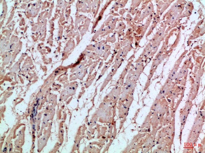 Fig.1. Immunohistochemical analysis of paraffin-embedded Human-heart, antibody was diluted at 1:100.