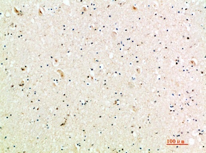 Fig.1. Immunohistochemical analysis of paraffin-embedded human-brain, antibody was diluted at 1:200.
