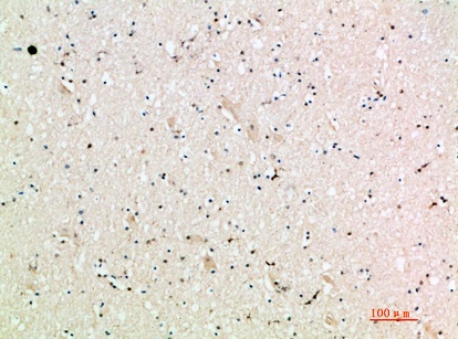 Fig.2. Immunohistochemical analysis of paraffin-embedded human-brain, antibody was diluted at 1:200.