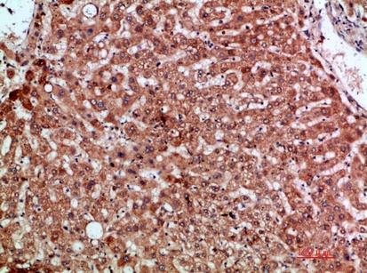Fig.1. Immunohistochemical analysis of paraffin-embedded human-liver, antibody was diluted at 1:200.