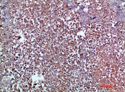 Fig.4. Immunohistochemical analysis of paraffin-embedded human-pancreas, antibody was diluted at 1:200.