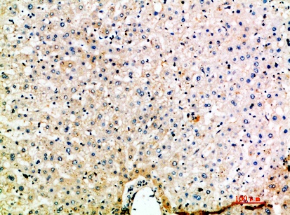 Fig.1. Immunohistochemical analysis of paraffin-embedded human-liver, antibody was diluted at 1:200.