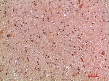 Fig.4. Immunohistochemical analysis of paraffin-embedded human-brain, antibody was diluted at 1:200.