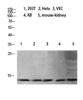 Fig.1. Western blot analysis of 3T3 Mouse-kidney KB K562 Hela 293T lysate, antibody was diluted at 1:1000. HRP, Goat Anti-Rabbit IgG (Cat #: A21020) secondary antibody was diluted at 1:20000.