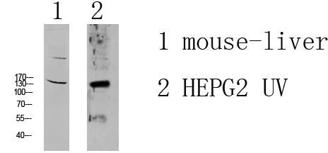 Fig.1. Western blot analysis of various lysate, antibody was diluted at 1:1000. HRP, Goat Anti-Rabbit IgG (Cat #: A21020) secondary antibody was diluted at 1:20000.