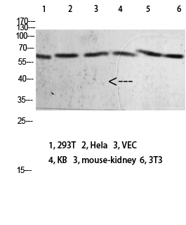 Fig.1. Western blot analysis of 293T Hela VEC KB Mouse-kidney 3T3 lysate, antibody was diluted at 1:2000. HRP, Goat Anti-Rabbit IgG (Cat #: A21020) secondary antibody was diluted at 1:20000.