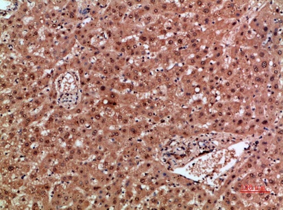Fig.2. Immunohistochemical analysis of paraffin-embedded human-liver, antibody was diluted at 1:200.
