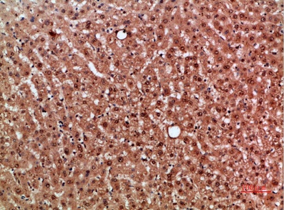 Fig.3. Immunohistochemical analysis of paraffin-embedded human-liver, antibody was diluted at 1:200.