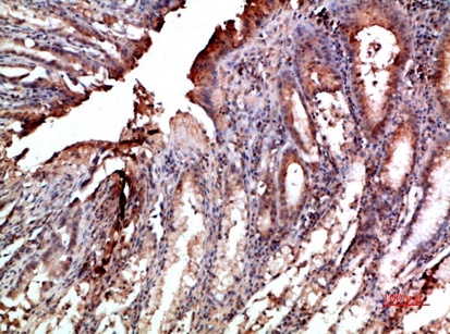 Fig.5. Immunohistochemical analysis of paraffin-embedded human-stomach, antibody was diluted at 1:200.
