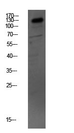 Fig.1. Western blot analysis of Mouse-kidney lysate, antibody was diluted at 1:1000. HRP, Goat Anti-Rabbit IgG (Cat #: A21020) secondary antibody was diluted at 1:20000.