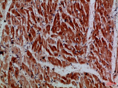Fig.1. Immunohistochemical analysis of paraffin-embedded Human-heart, antibody was diluted at 1:100.