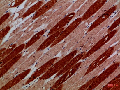 Fig.2. Immunohistochemical analysis of paraffin-embedded Human-skeletal-muscle, antibody was diluted at 1:100.