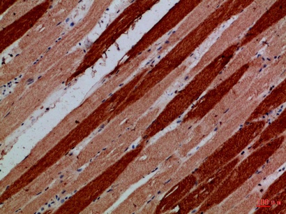 Fig.3. Immunohistochemical analysis of paraffin-embedded Human-skeletal-muscle, antibody was diluted at 1:100.