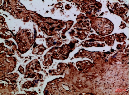 Fig.1. Immunohistochemical analysis of paraffin-embedded Human-placenta, antibody was diluted at 1:100.
