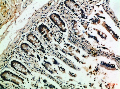 Fig.1. Immunohistochemical analysis of paraffin-embedded Human-colon, antibody was diluted at 1:100.