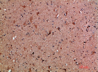 Fig.1. Immunohistochemical analysis of paraffin-embedded human-brain, antibody was diluted at 1:200.