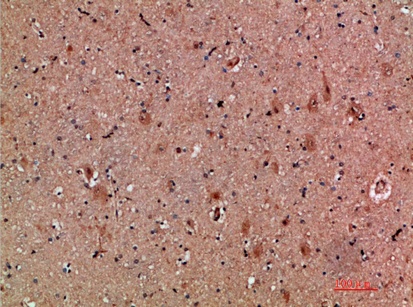 Fig.2. Immunohistochemical analysis of paraffin-embedded human-brain, antibody was diluted at 1:200.