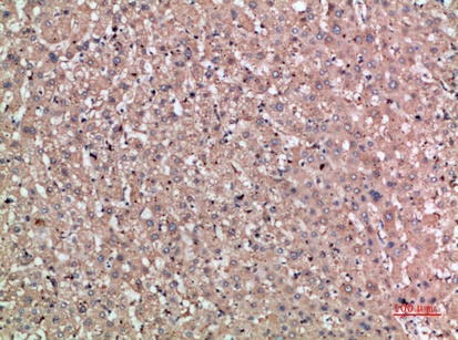Fig.1. Immunohistochemical analysis of paraffin-embedded human-liver, antibody was diluted at 1:200.
