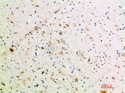Fig.2. Immunohistochemical analysis of paraffin-embedded human-brain, antibody was diluted at 1:200.