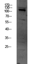 Fig.1. Western blot analysis of HEPG2 lysate, antibody was diluted at 1:1000. HRP, Goat Anti-Rabbit IgG (Cat #: A21020) secondary antibody was diluted at 1:20000.