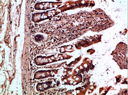 Fig.1. Immunohistochemical analysis of paraffin-embedded human-colon, antibody was diluted at 1:200.