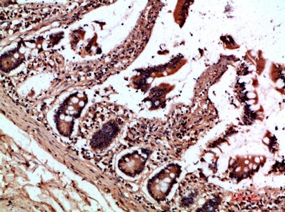 Fig.2. Immunohistochemical analysis of paraffin-embedded human-colon, antibody was diluted at 1:200.
