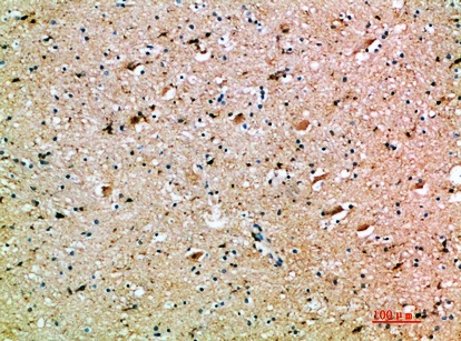 Fig.3. Immunohistochemical analysis of paraffin-embedded human-brain, antibody was diluted at 1:200.