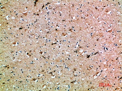 Fig.4. Immunohistochemical analysis of paraffin-embedded human-brain, antibody was diluted at 1:200.