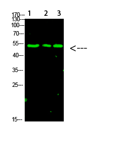Fig.1. Western Blot analysis of 1, Mouse-liver 2, hela 3,Mouse-brain cells using primary antibody diluted at 1:1000 (4°C overnight). Goat Anti-rabbit IgG Dylight 800 (Cat #: A23920) secondary antibody was diluted at 1:5000 at 25°C for 1 hour.