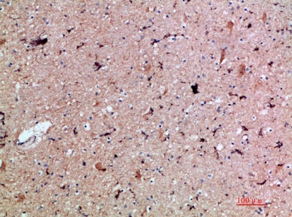 Fig.1. Immunohistochemical analysis of paraffin-embedded human-brain, antibody was diluted at 1:200.