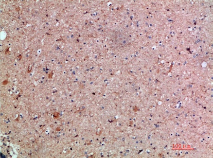 Fig.2. Immunohistochemical analysis of paraffin-embedded human-brain, antibody was diluted at 1:200.