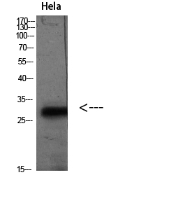Fig.1. Western blot analysis of Hela (TSA 400nM 24h) lysate, antibody was diluted at 1:2000. HRP, Goat Anti-Rabbit IgG (Cat #: A21020) secondary antibody was diluted at 1:20000.