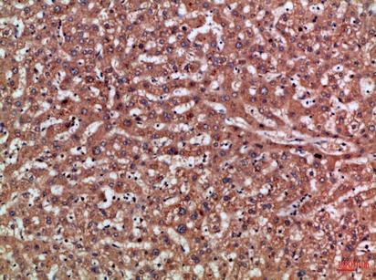 Fig.2. Immunohistochemical analysis of paraffin-embedded Human-liver, antibody was diluted at 1:100.