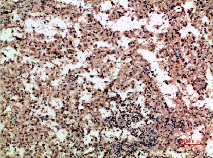 Fig.1. Immunohistochemical analysis of paraffin-embedded human-spleen, antibody was diluted at 1:200.