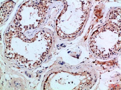 Fig.1. Immunohistochemical analysis of paraffin-embedded Human-testis, antibody was diluted at 1:100.