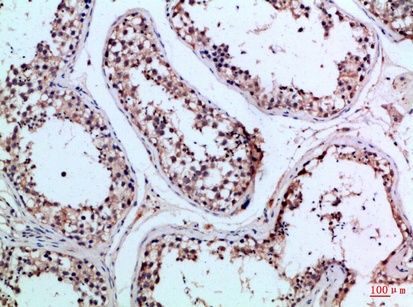 Fig.2. Immunohistochemical analysis of paraffin-embedded Human-testis, antibody was diluted at 1:100.