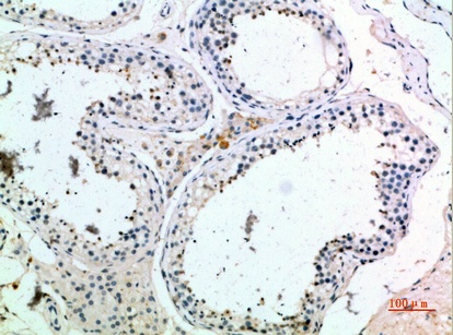 Fig.1. Immunohistochemical analysis of paraffin-embedded human-testis, antibody was diluted at 1:200.