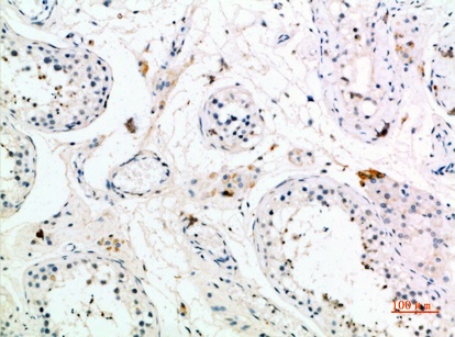 Fig.2. Immunohistochemical analysis of paraffin-embedded human-testis, antibody was diluted at 1:200.