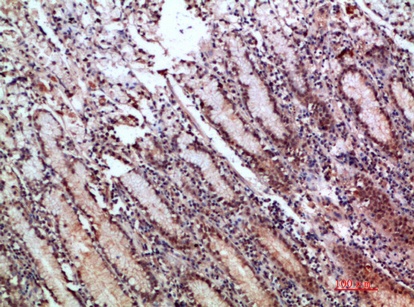 Fig.3. Immunohistochemical analysis of paraffin-embedded human-stomach, antibody was diluted at 1:200.