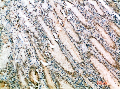 Fig.4. Immunohistochemical analysis of paraffin-embedded human-stomach, antibody was diluted at 1:200.