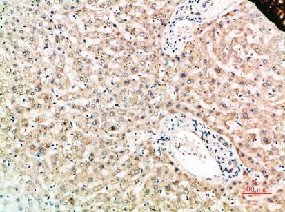 Fig.2. Immunohistochemical analysis of paraffin-embedded human-liver, antibody was diluted at 1:200.