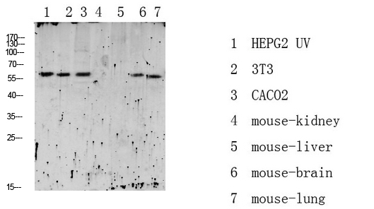 Fig.1. Western blot analysis of various lysate, antibody was diluted at 1:1000. HRP, Goat Anti-Rabbit IgG (Cat #: A21020) secondary antibody was diluted at 1:20000.